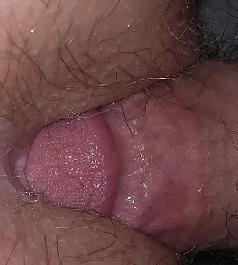 🤩🤩