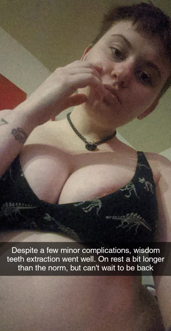 🦷🦷🦷