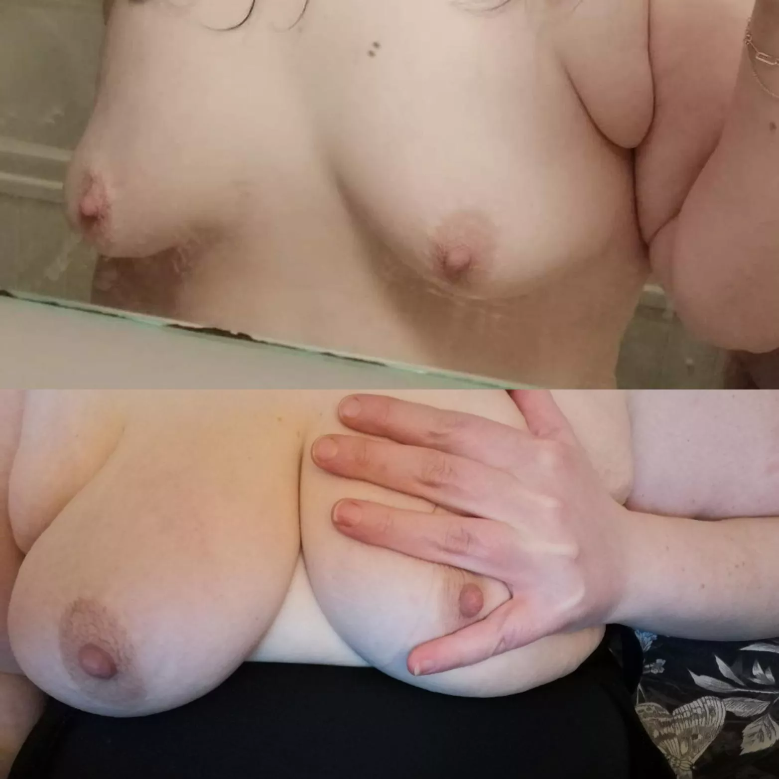 1st round of injections to grow them bigger, I'm not even close to my end goal but what a big difference 😍