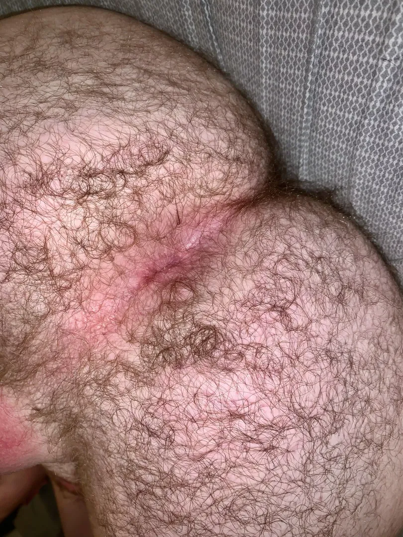 😈 [20]