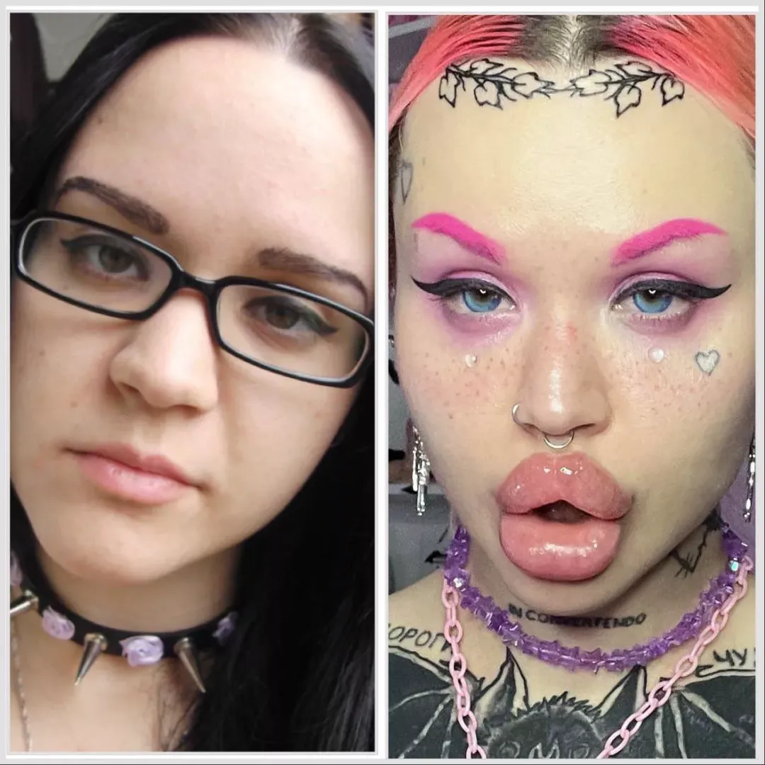 20 vs 28