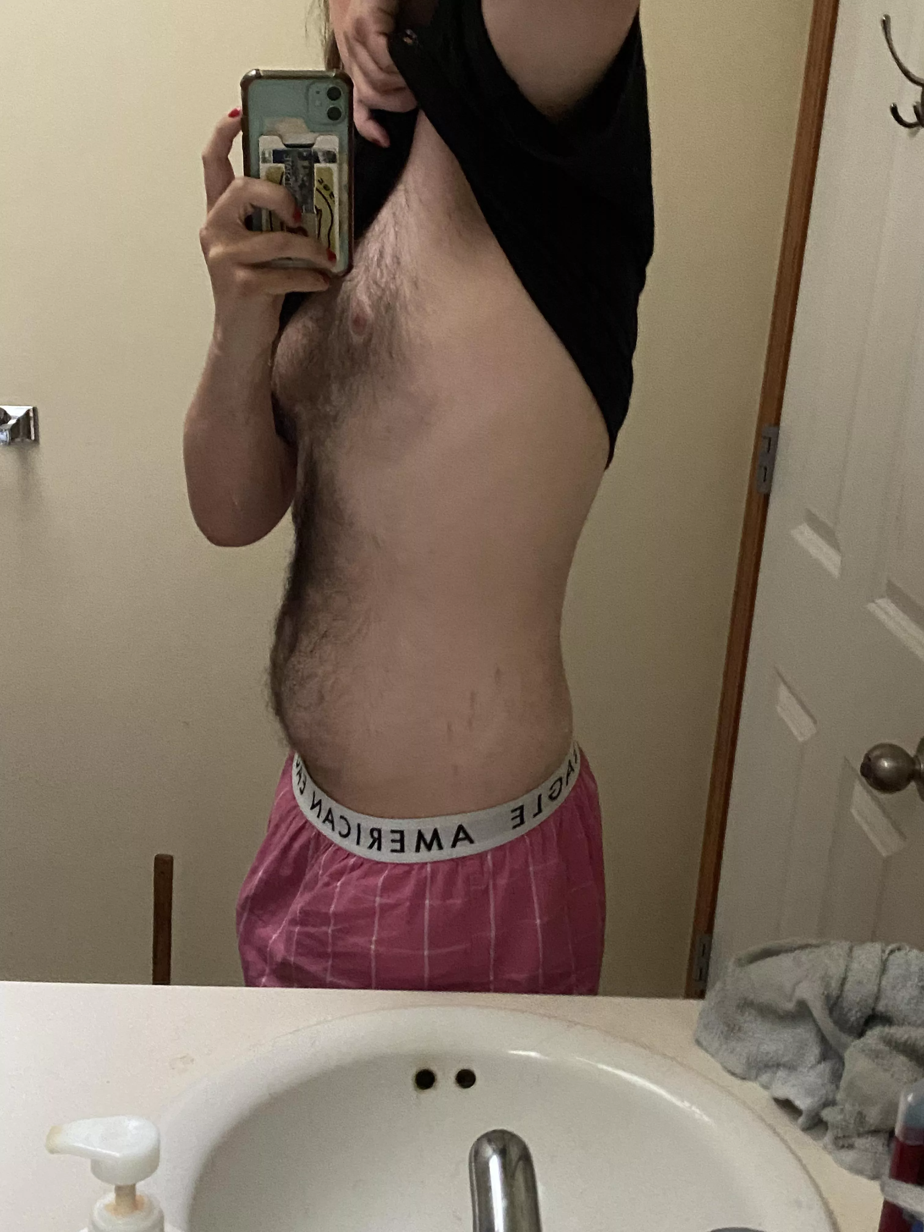 20m