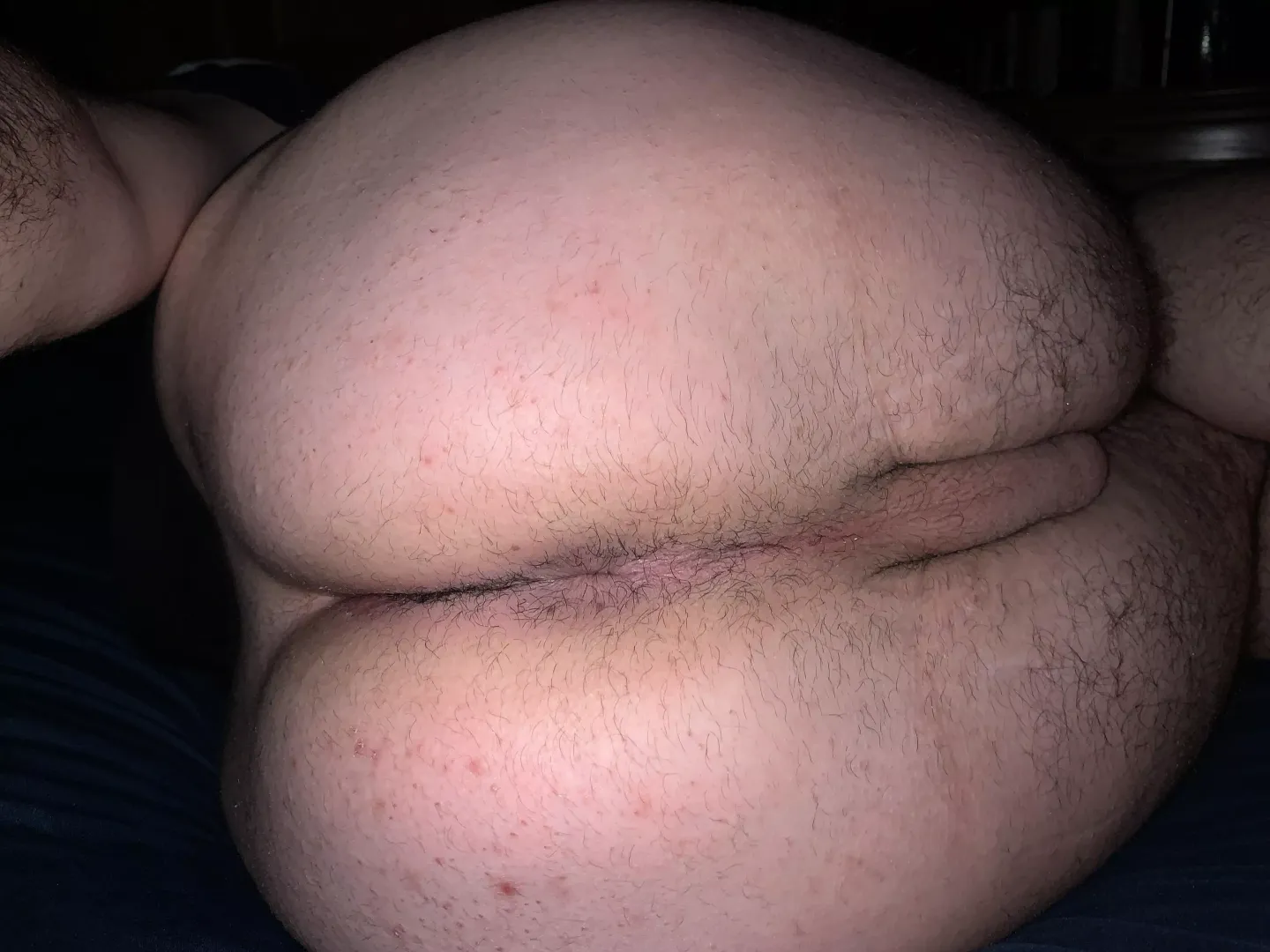 22 HMU