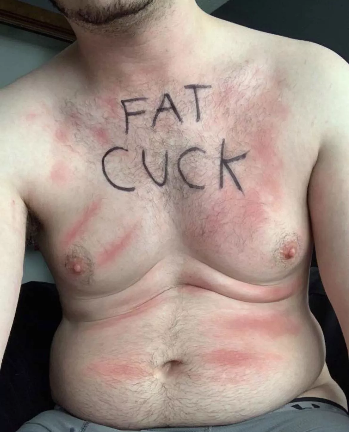 24 [M4M] Sub guy looking to be bullied and humiliated by a sadistic dom. Picture is a post beating, think you could do worse?