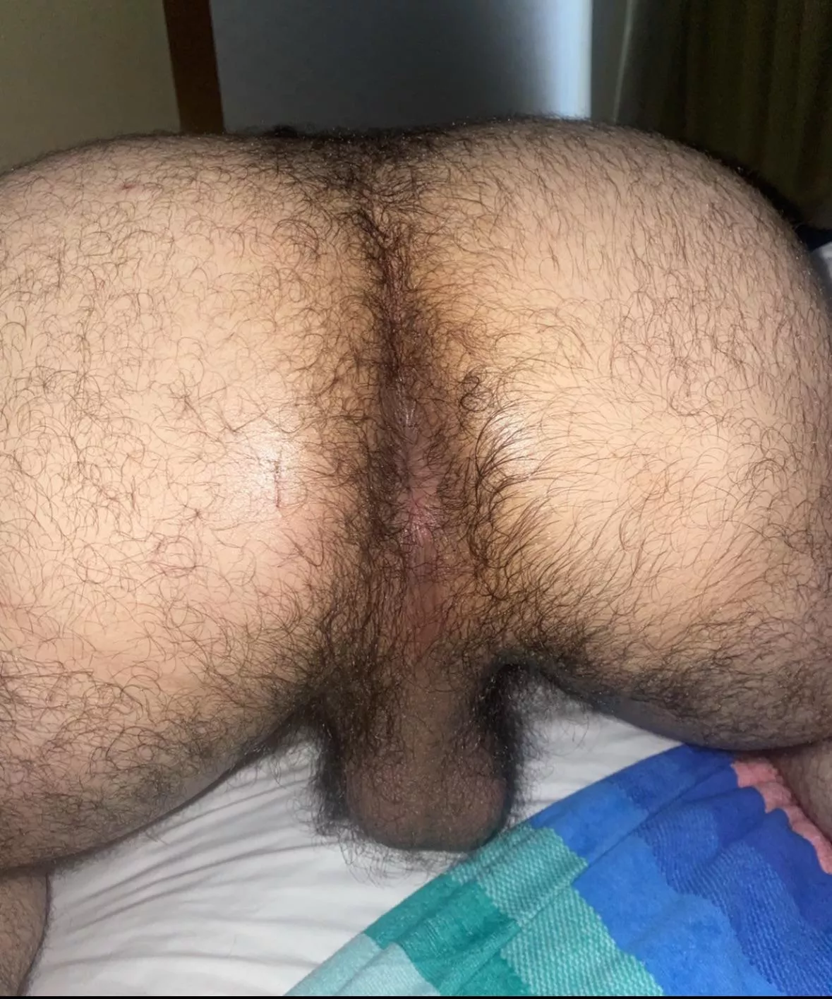 25, into hairy hole? SC: q552498