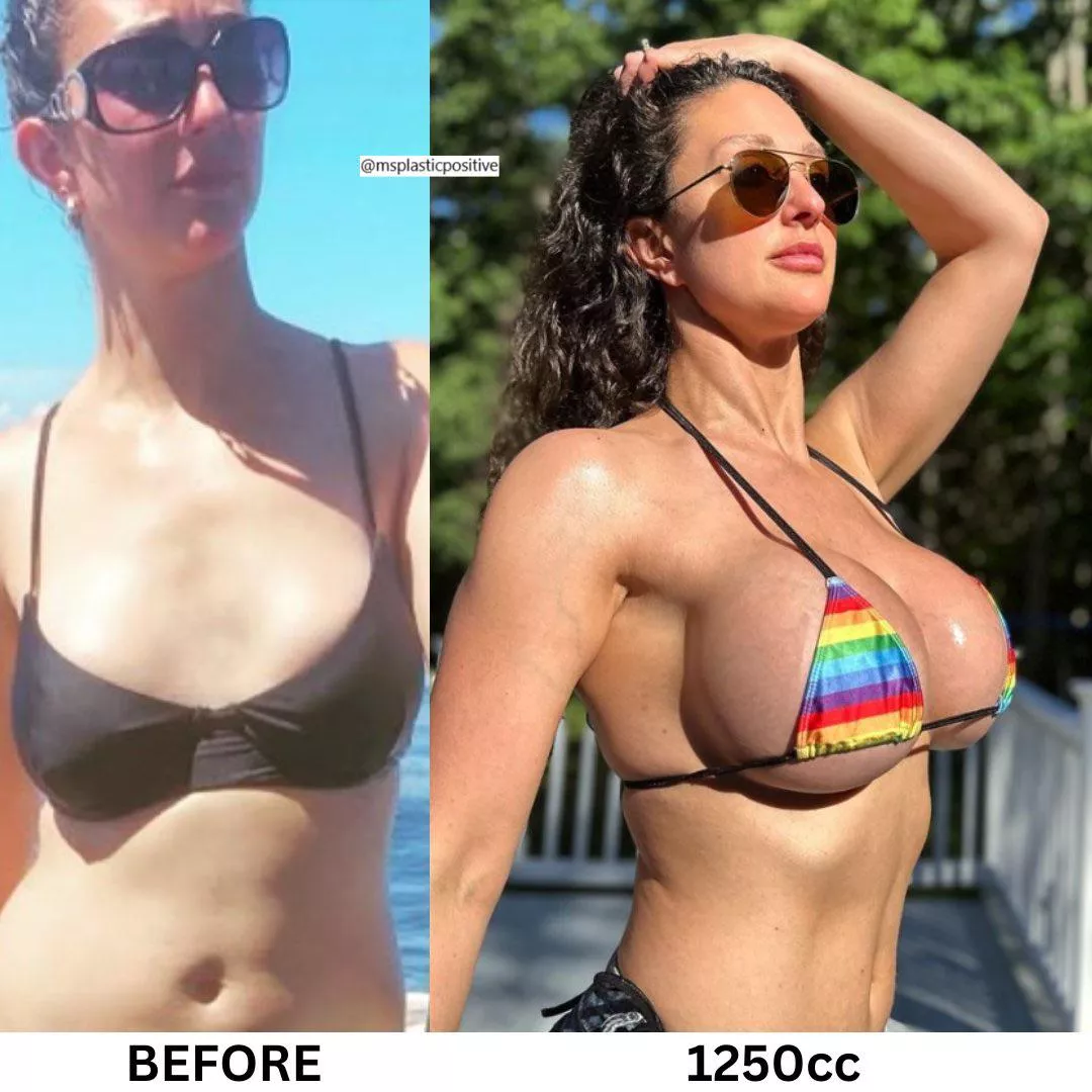 3 year difference- 34A to 34H 
