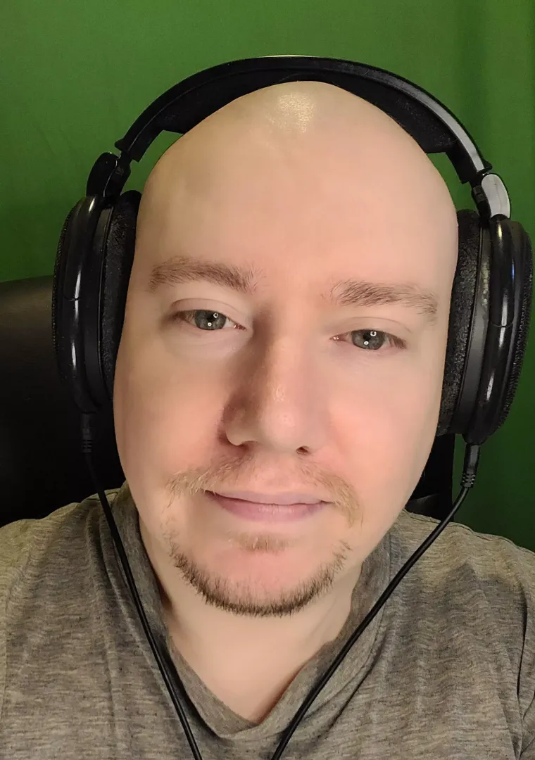 30s scottish guy trying out being bald <3