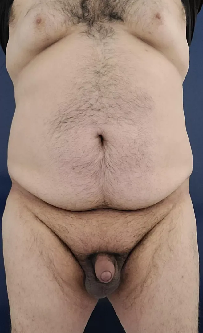 31 m