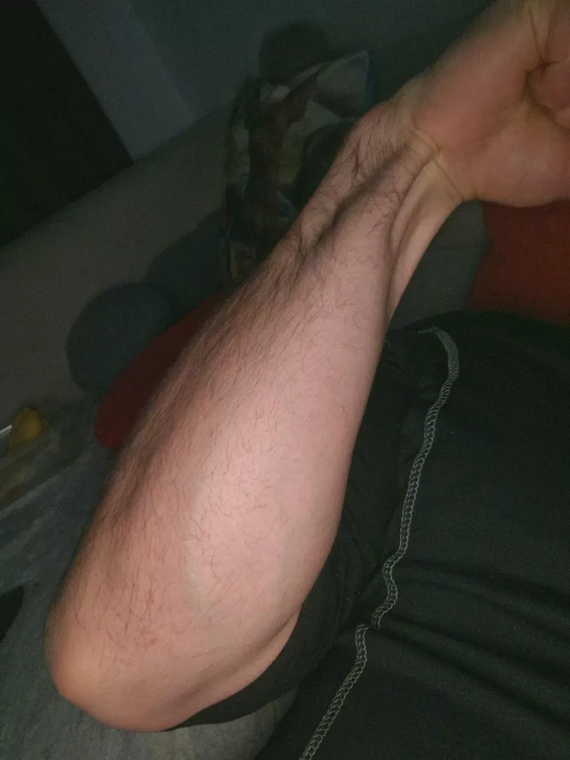 35 cm
