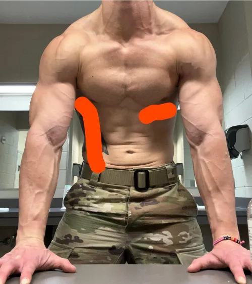 36, Army Guard