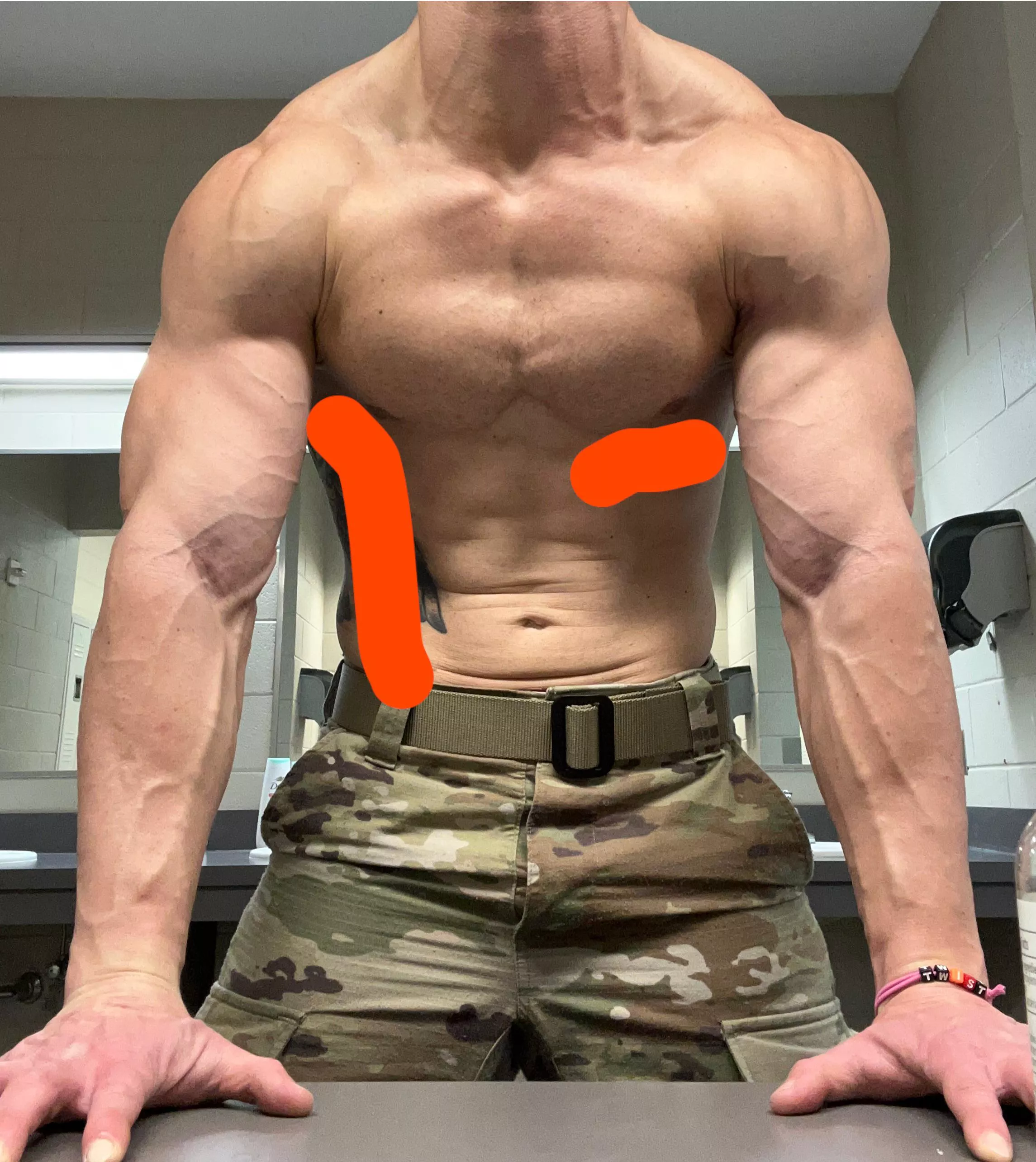 36, Army Guard