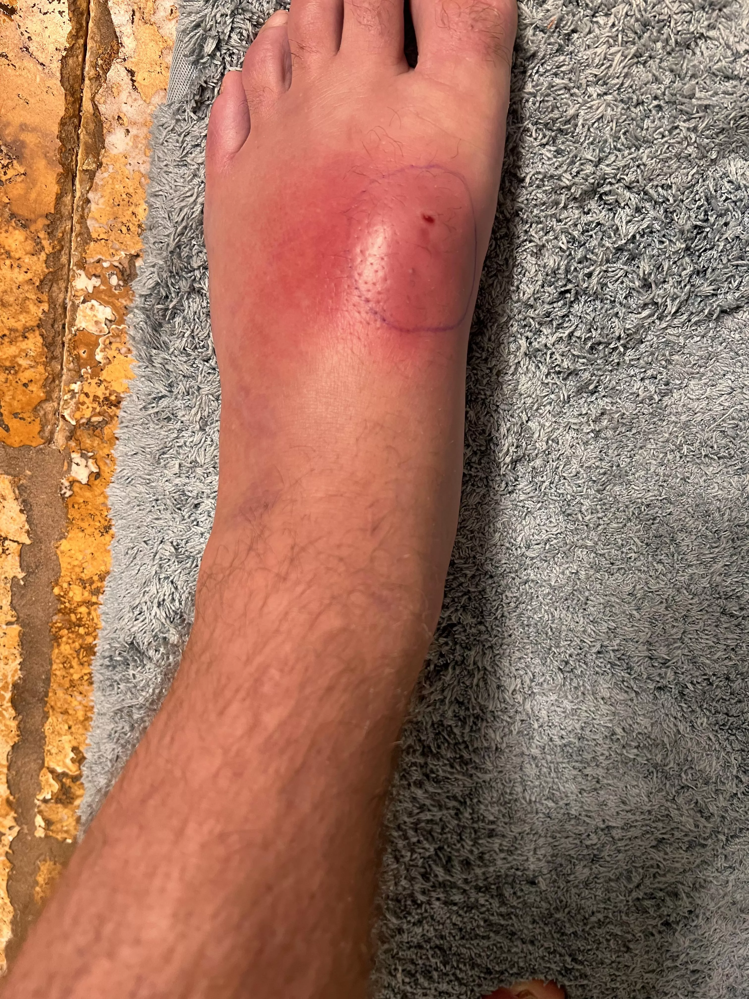 5 days swollen 
