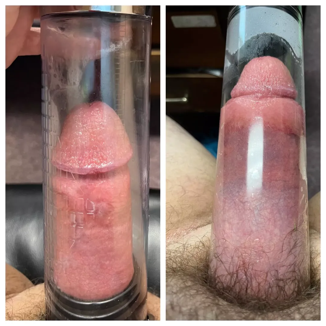 5 min vs 90 min