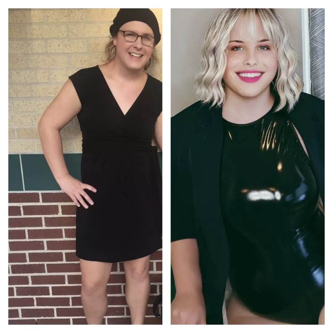 5 years and a lot of plastic later I ended up as a shiny bimbo!