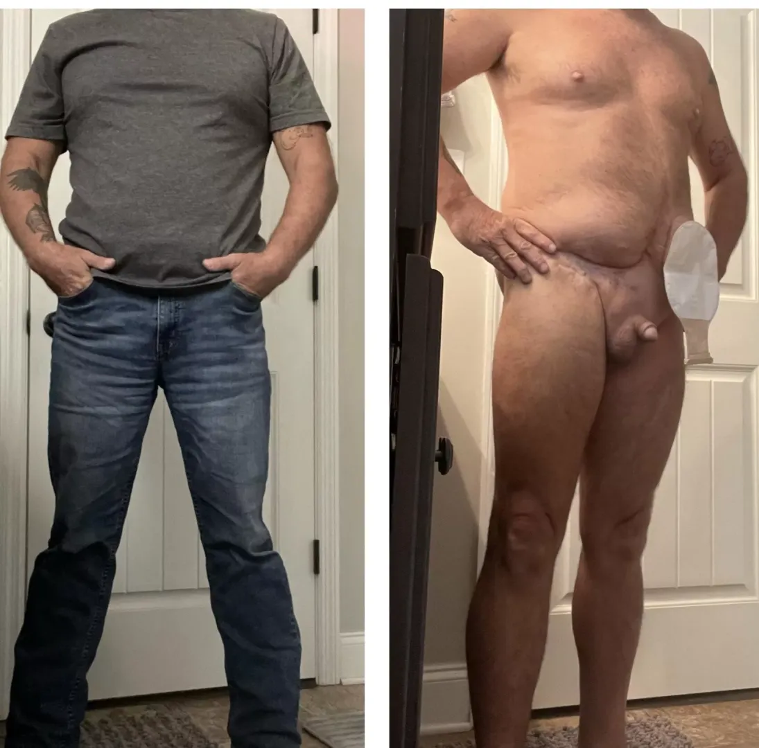 55- 5’6”-175. I’m not looking for pity. Just know, when you see people on the street you never know what struggles they hide.