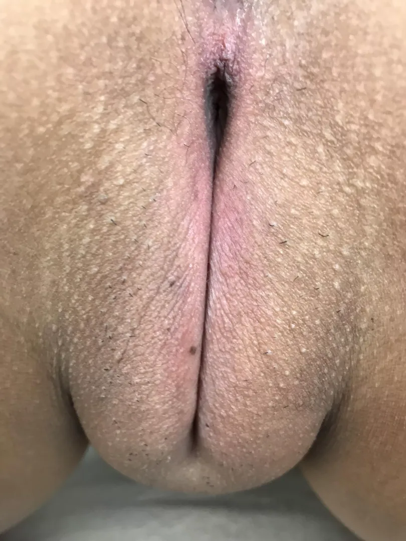 A close up of my pussy…looks like I missed a few pubics!