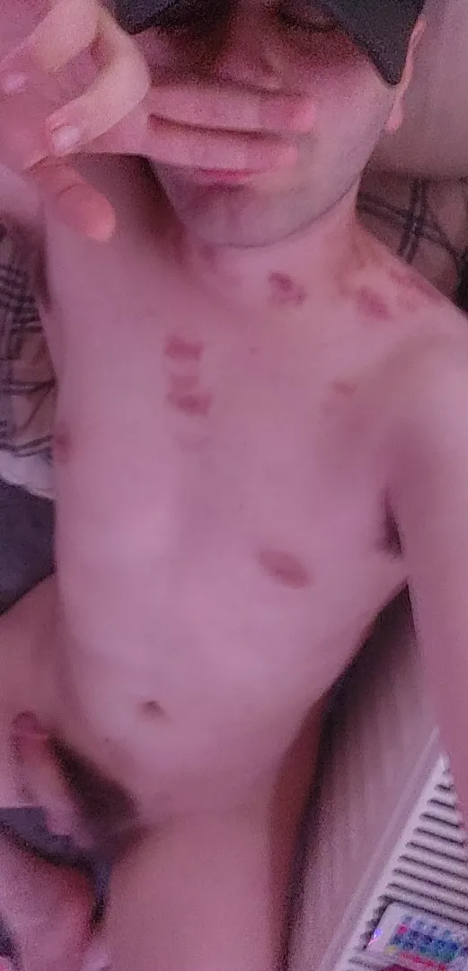 aftermath