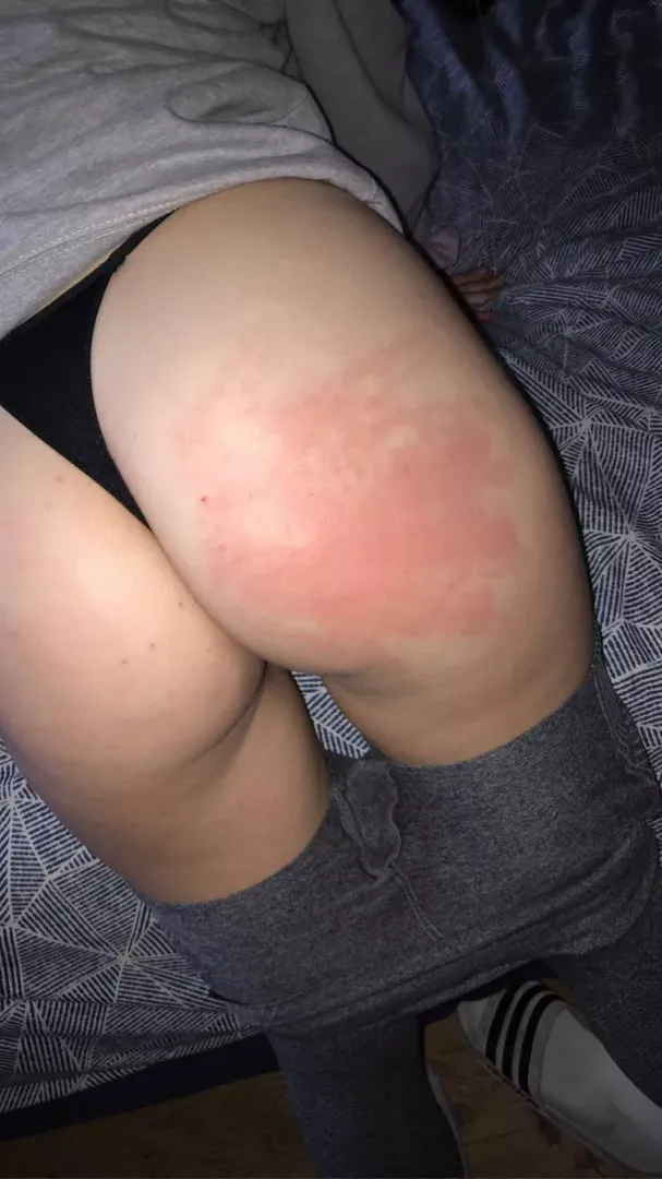 Aftermath from my sisters boyfriend…..ooops🫣