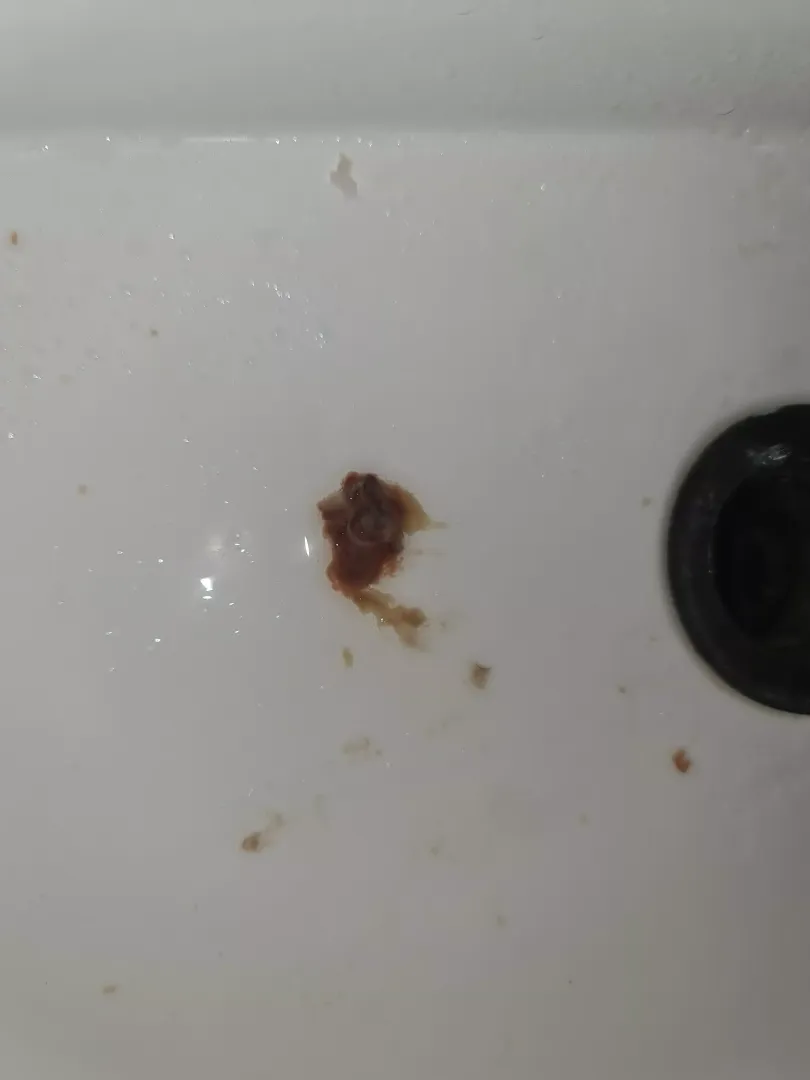 Aftermath of Nasal Polyps/Blockages