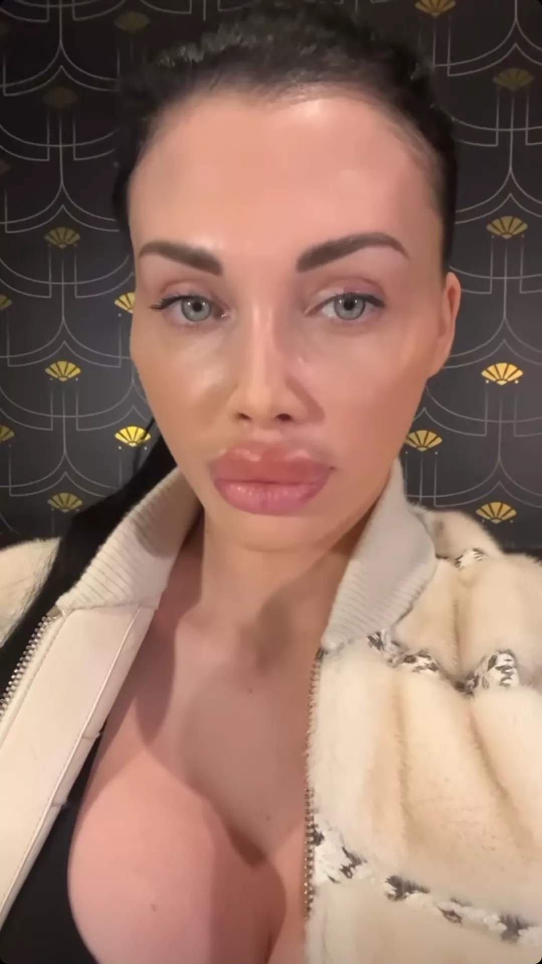 Aletta's lips looking perfect