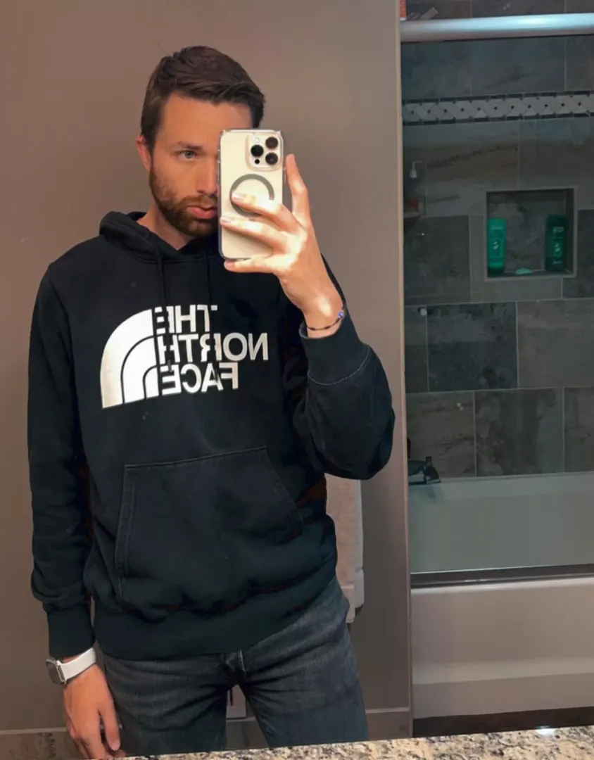 Am I ugly?