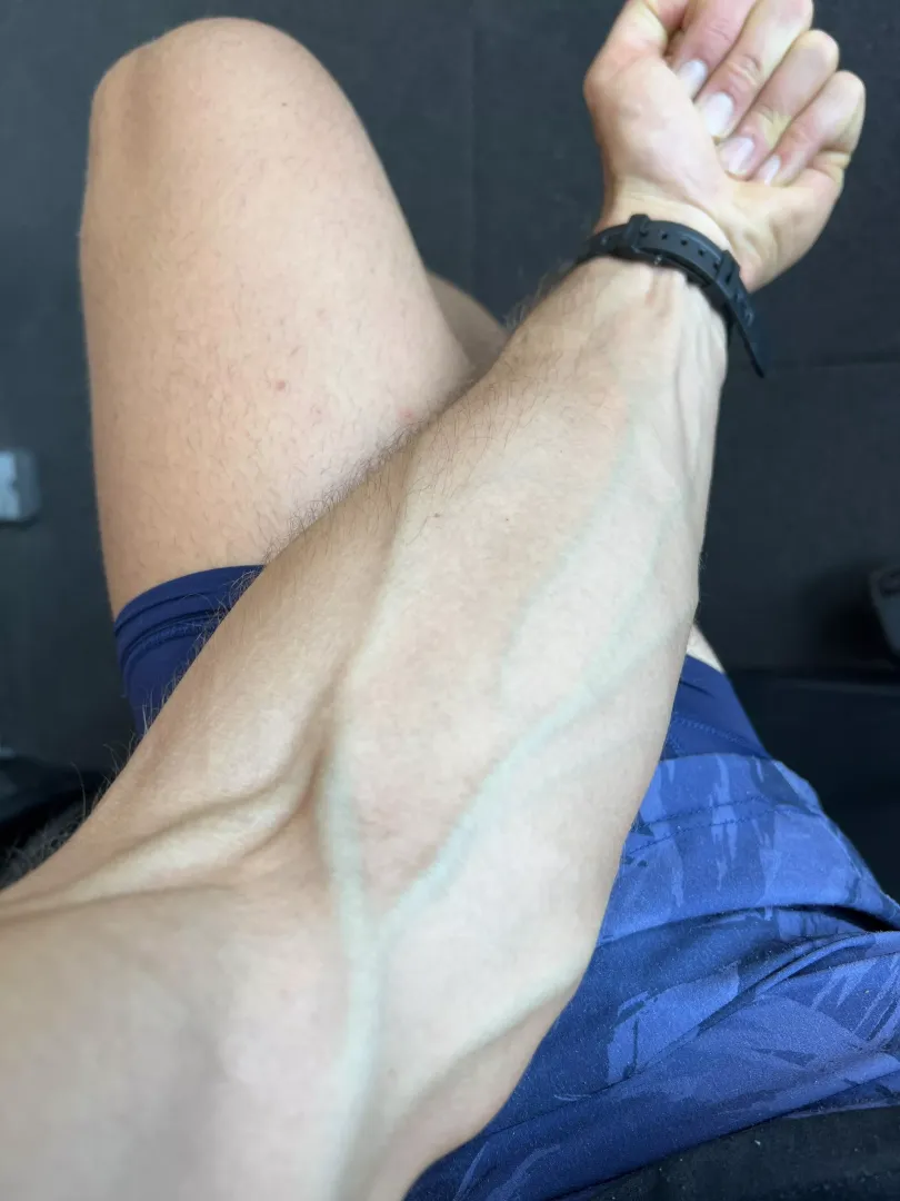 Any nurses in here?