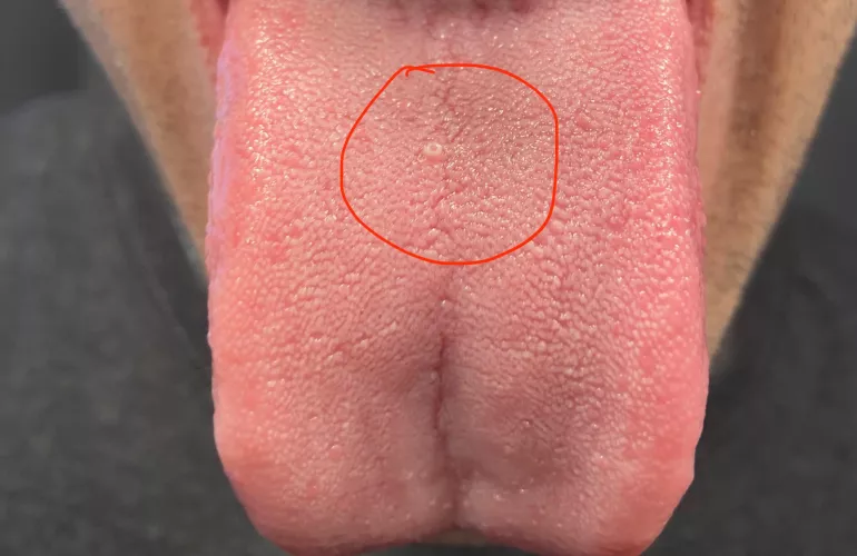 Anyone have any idea what this is? I’ve popped a couple times now.