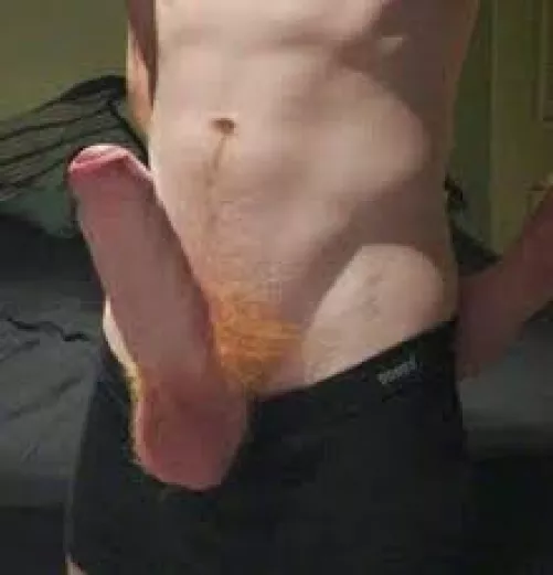 Anyone want some ginge