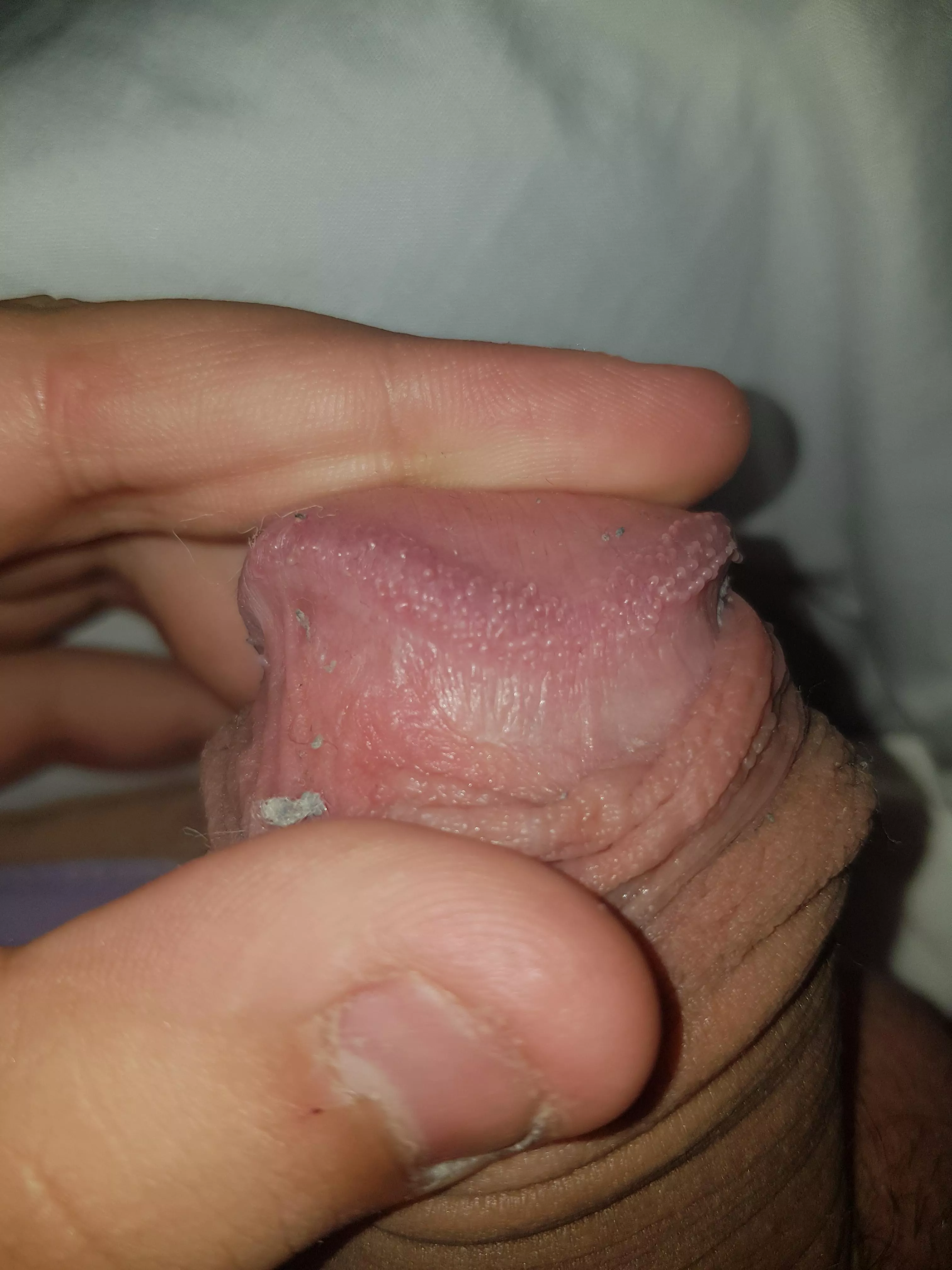 are these harmful
