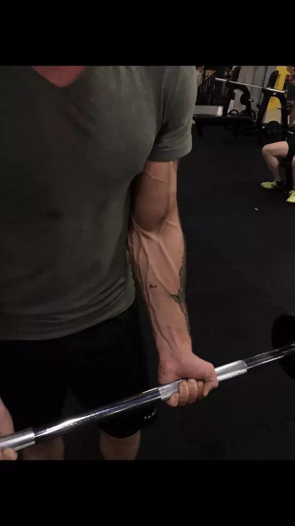 Arm pump 22M