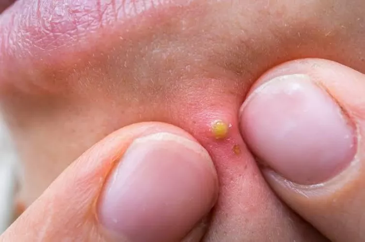 As a doctor who posts to popping. The comments are out of control.