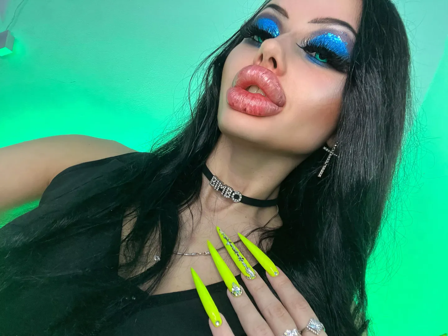 Augmented my lips again