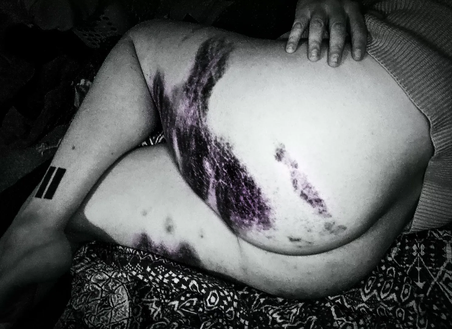 Beaten, but not Broken