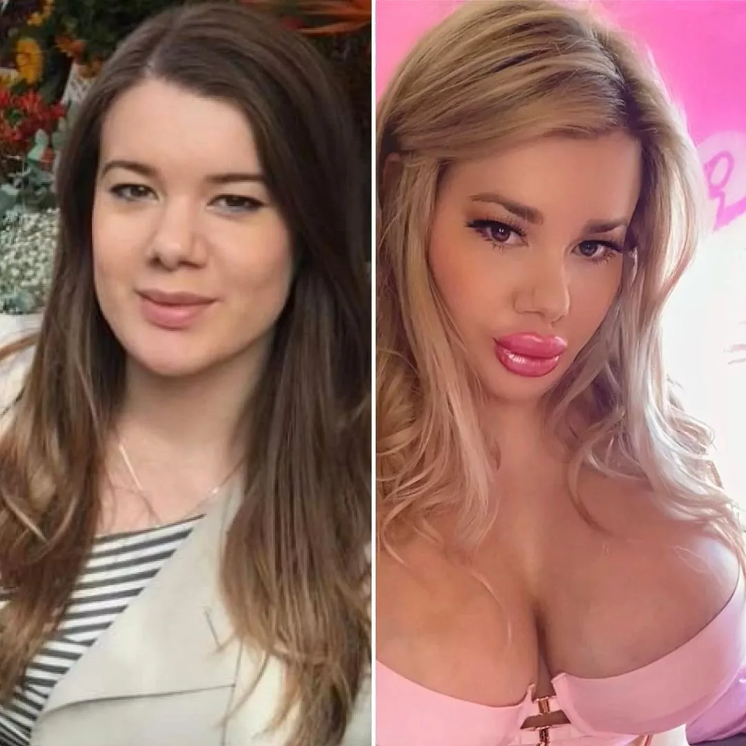Before & After