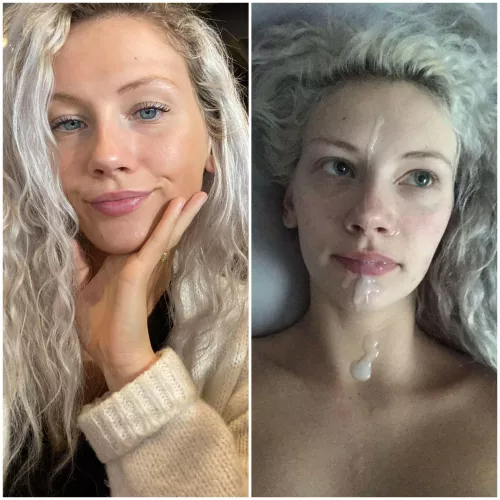 Before & after facial