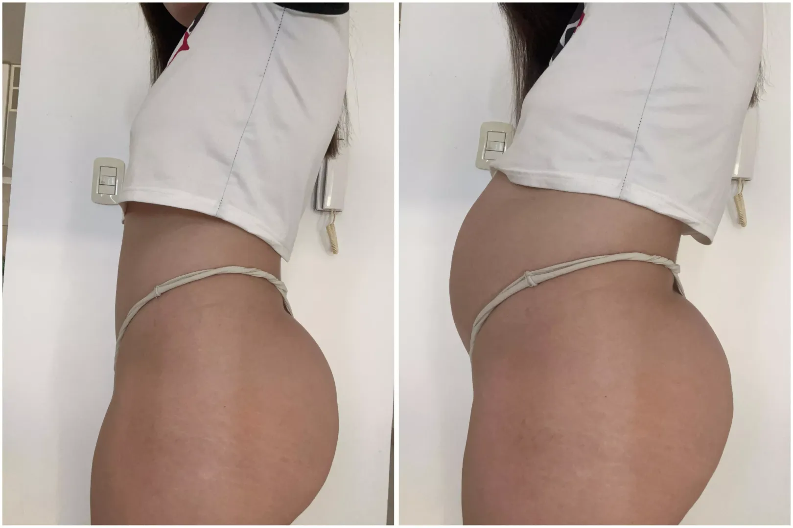 Before and after 