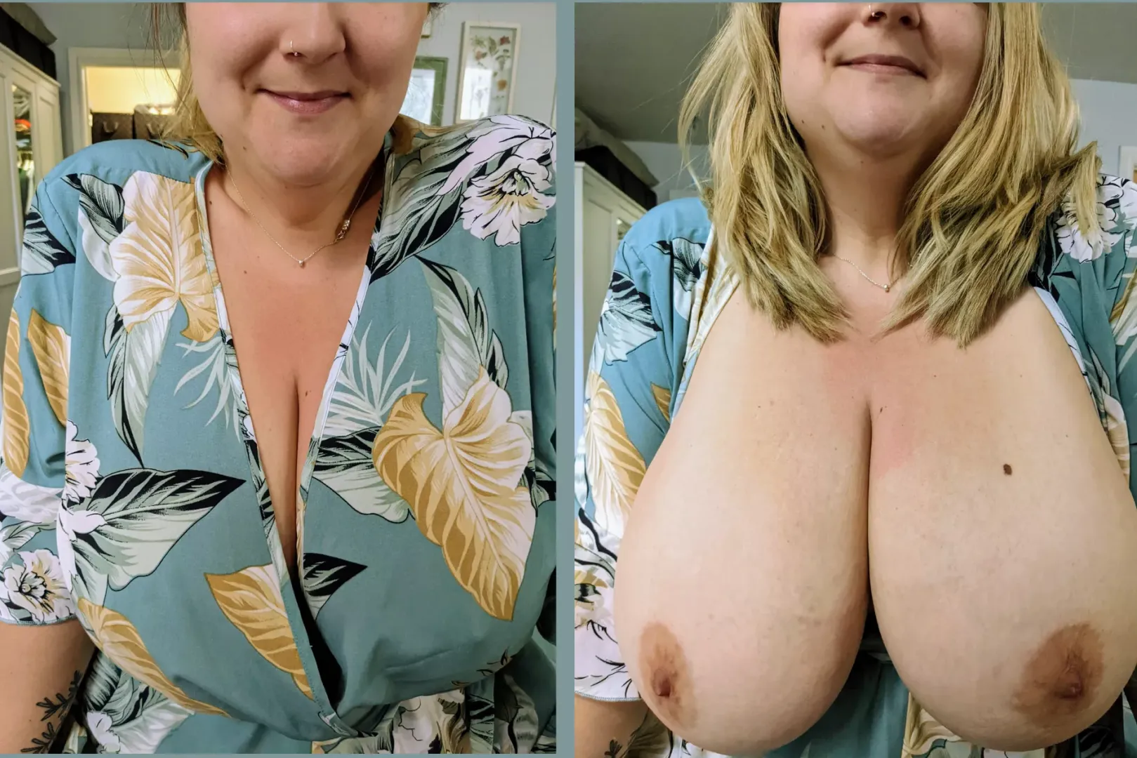 Before and After