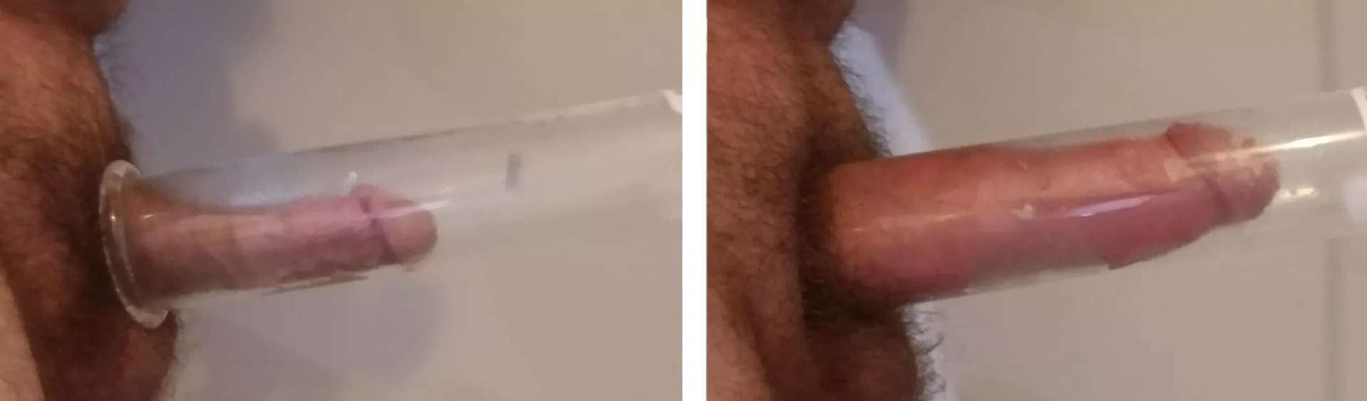 Before and during