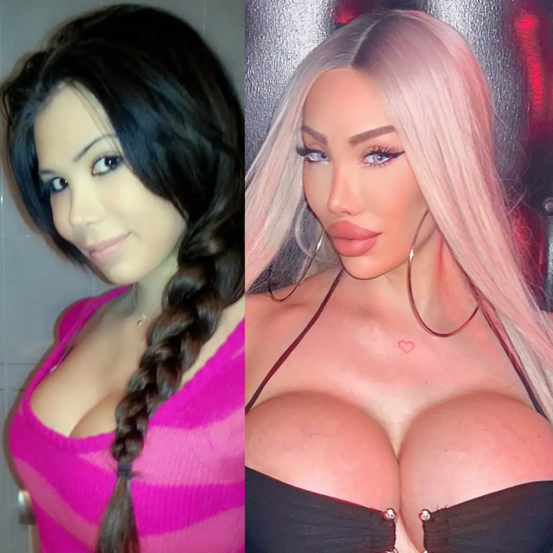 Before or after?