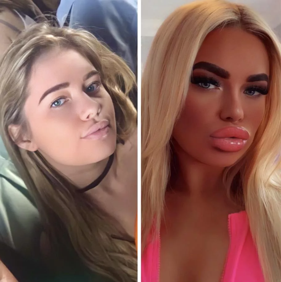 Before/After