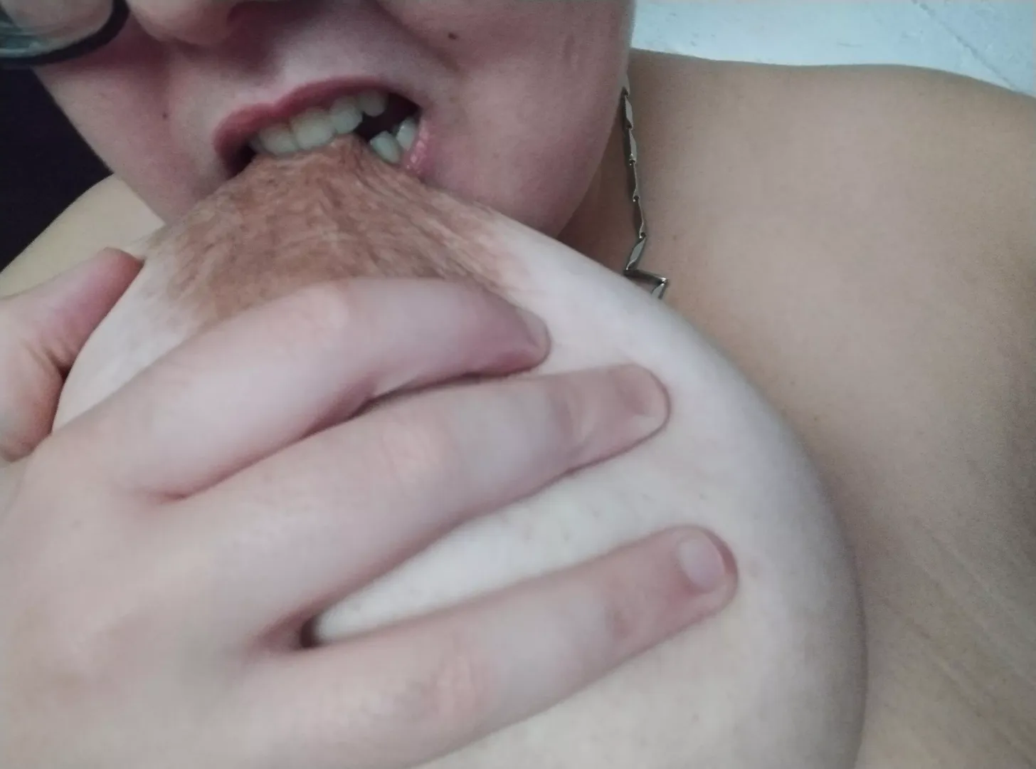 Biting?