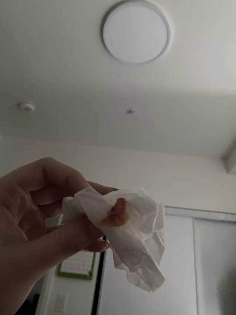 Blew this out of my nose today. Pretty sure I have Covid.