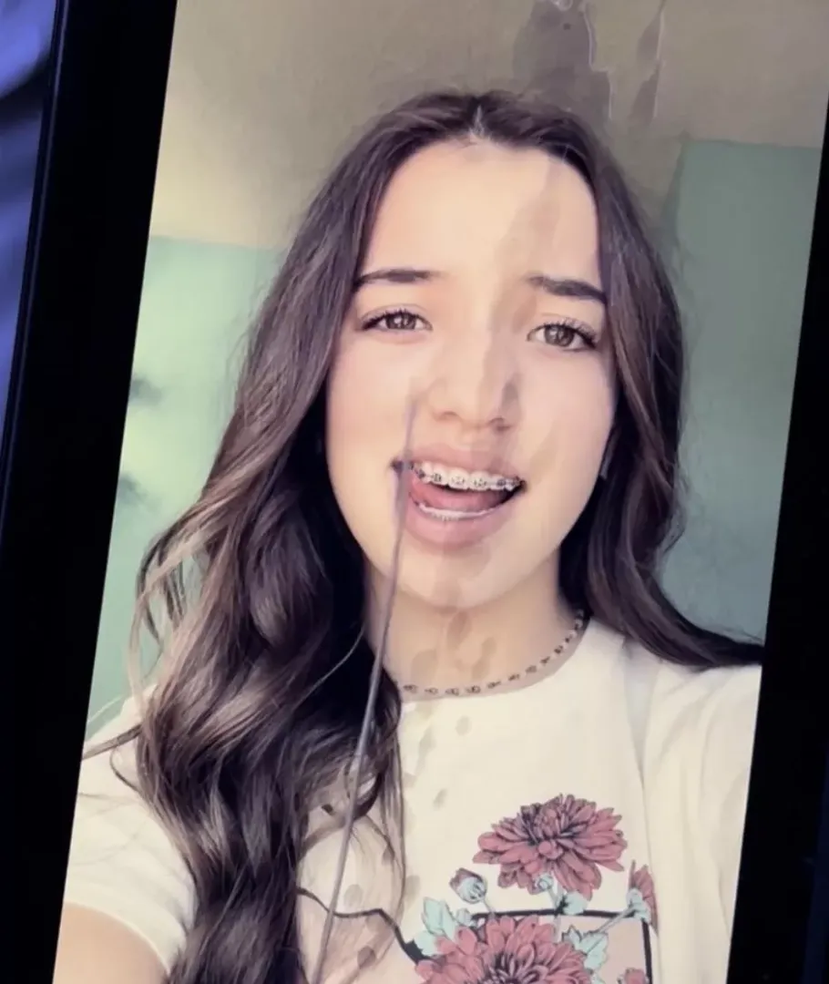 Brace face