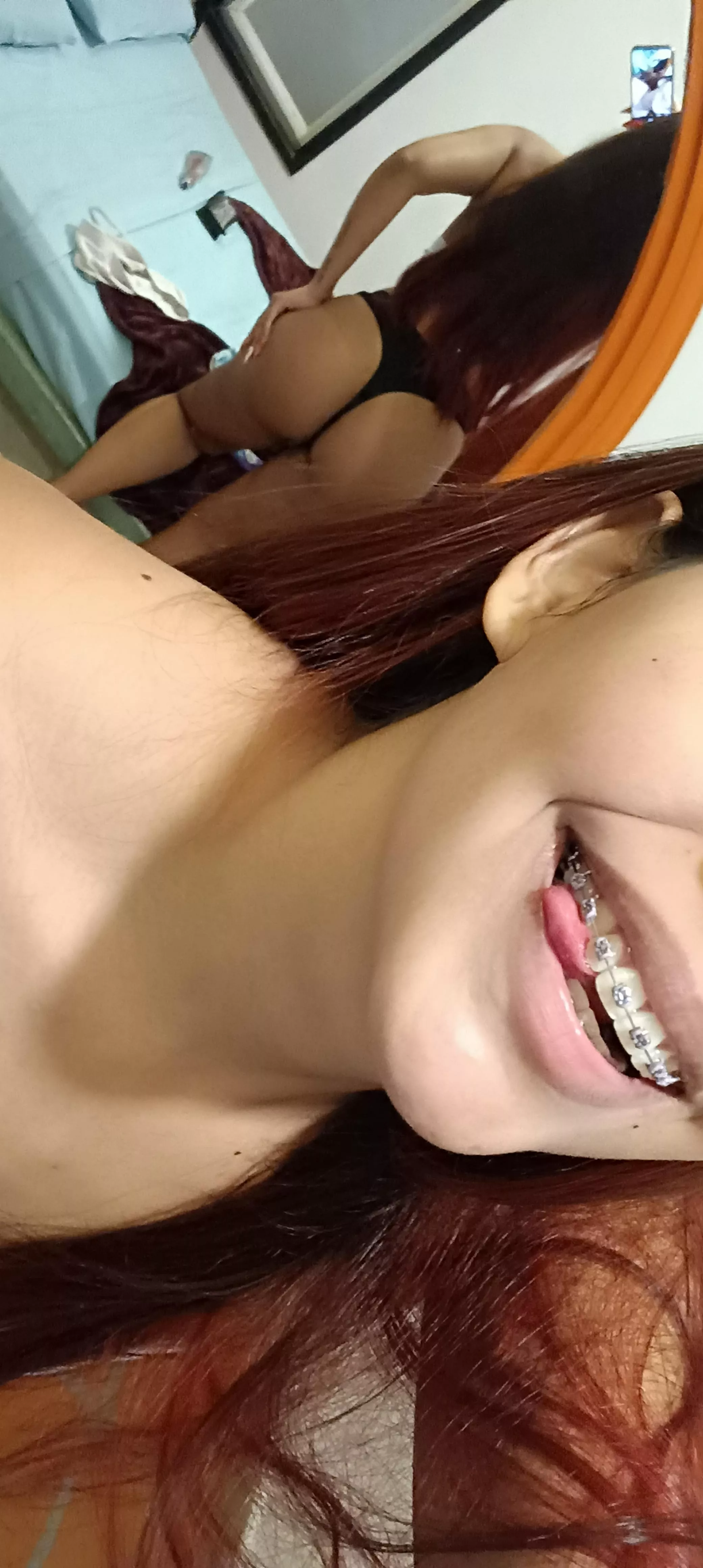 Braces and butt what's your favorite?