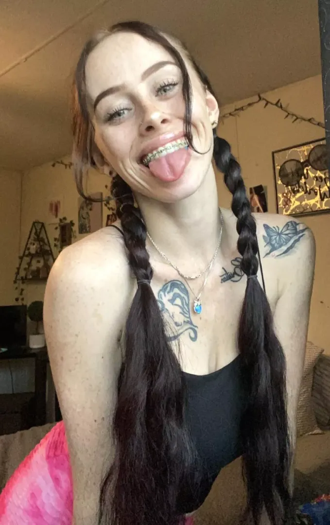 Braces, freckles & dimples 💕🥵