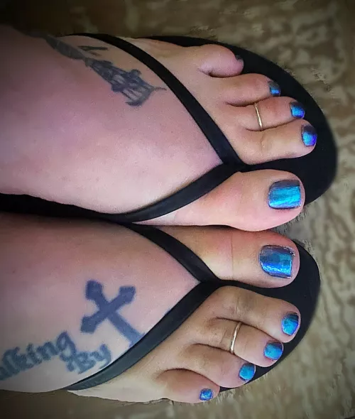 Bruised toes but still cute doe 🥰