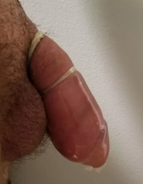 Burst through a condom