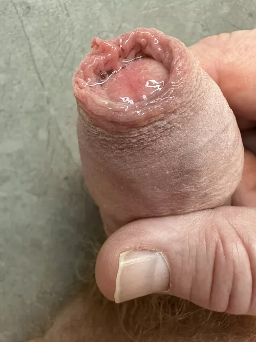 Catches the precum