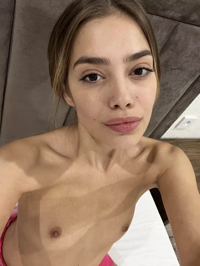 cherries or melons