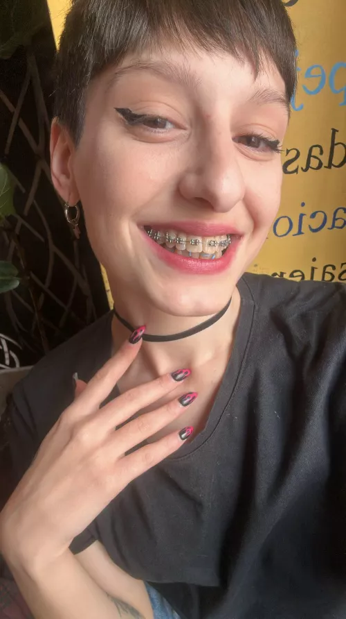 could you imagine to cum on these braces?